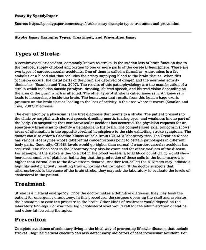 Stroke Essay Example: Types, Treatment, and Prevention